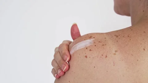 Freckled Skin Care Routine: Applying Cream for Hydration and Protection Stock Footage 282207748