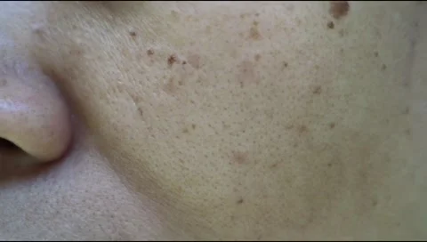 Freckles1 Stock Footage 280374615