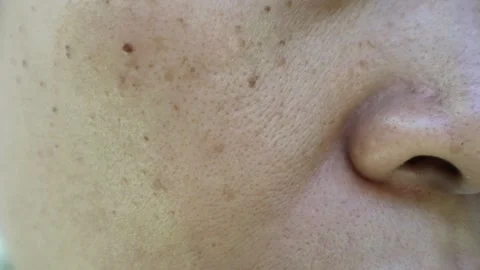 Freckles3 Stock Footage 280374590