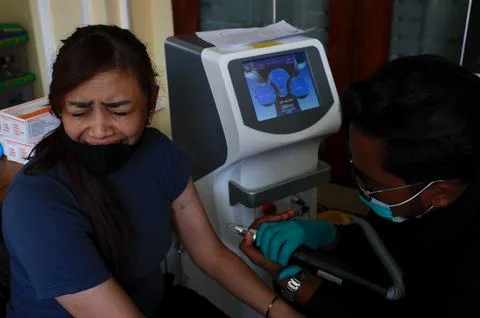 Free tattoo removal program during Ramadan in Jakarta, Indonesia - 24 Feb 2026 Stock Photos