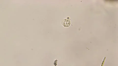 Freshwater Amoeba under brightfield microscope - 400X Stock Footage 303038936
