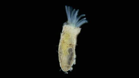 Freshwater bryozoans under microscope, Class Phylactolaemata Video stock 160403038