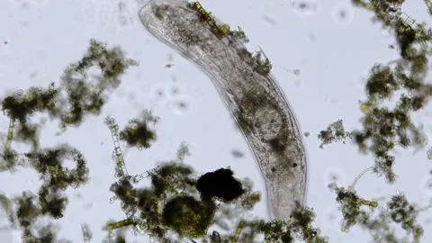 Freshwater flatworm Turbellaria under the microscope Stock Footage 234082569