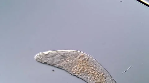 Freshwater flatworm under DIC microscope, 400x 스톡 동영상 317211166