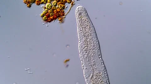 Freshwater flatworms, microscope view 400x 스톡 동영상 317210857