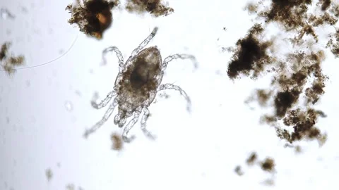 Freshwater halacarid mite under the microscope Stock Footage 276237603