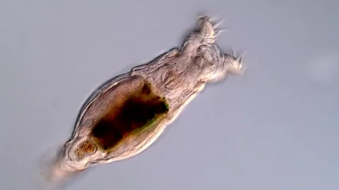 Freshwater Rotifer 스톡 동영상 310646217