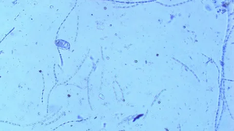 Freshwater rotifer under microscope-100x magnification Stock Footage 302708796