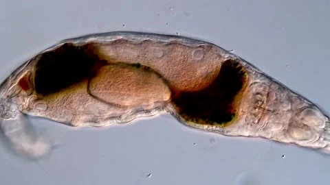 Freshwater Rotifer under microscope Vidéo 310646394