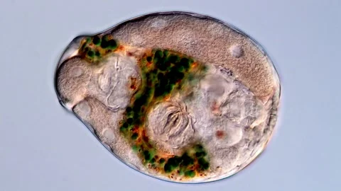 Freshwater Rotifer under microscope Vídeos de archivo 310646952