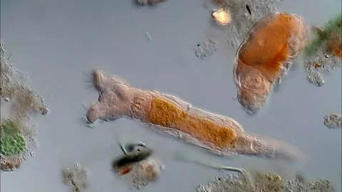 Freshwater Rotifer under microscope view 库存影片 306576688