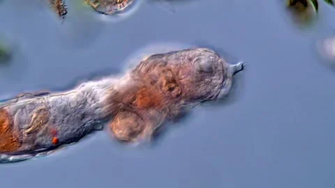Freshwater Rotifer under microscopy view 库存影片 310311430