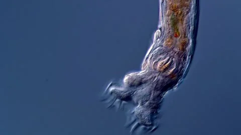 Freshwater Rotifer under microscopy view 库存影片 310313696