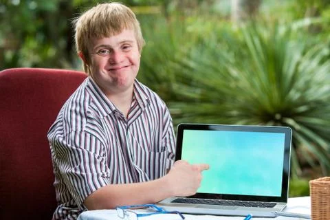 Friendly boy with down syndrome pointing at blank laptop screen. Stock Photos