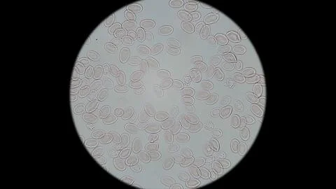 Frog blood under a microscope. Red blood cells have an oval shape and a nuc.. Stock Photos