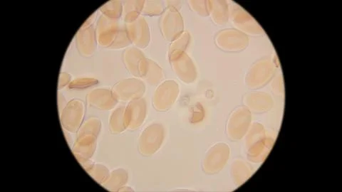 Frog blood under a microscope. Red blood cells have an oval shape and a nuc.. Stock Photos