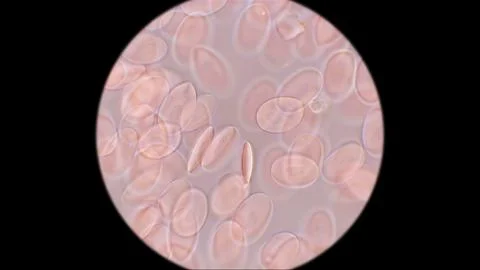 Frog blood under a microscope. Red blood cells have an oval shape and a nuc.. Stock Photos