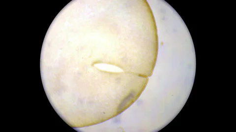 Frog Holoblastic 800x 1000x 2000x Stock Footage 39806620