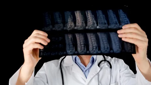 Front view of radiologist holding x-ray Stock Footage 126619956