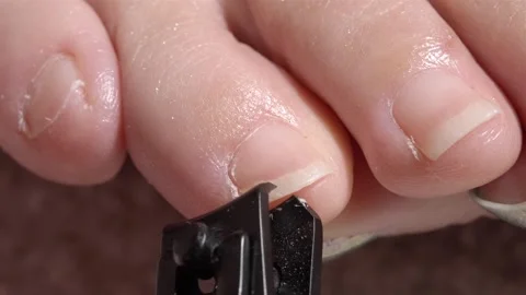 Front View Slow Motion of Toenails Being Cut with Black Clipper Stock Footage 309171860