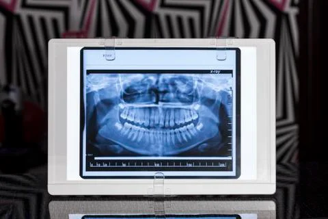 Front View Xray Stock Photos