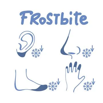 Frostbite icons set. Outline set of frostbite vector icons for web design iso Stock Illustration