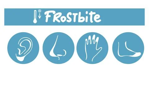 Frostbite icons set. Outline set of frostbite vector icons for web design iso Stock Illustration