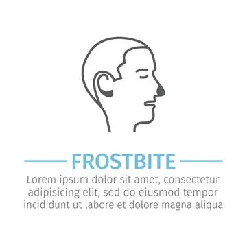 Frostbite line icon. Vector sign for web graphic. Stock Illustration