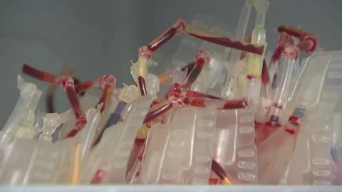 Frozen donor blood Stock Footage 95358003