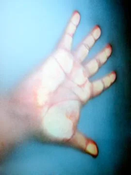 Frozen man Foto stock