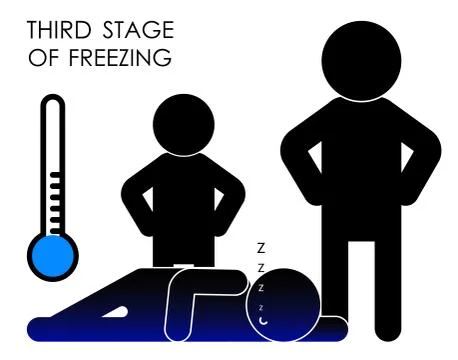 Frozen man, signs of the third stage of hypothermia. Low body temperature Stock Illustration