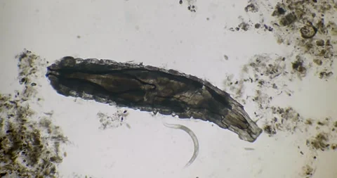Fruit fly larva feeding backlit and nematode Stock Footage 197005766