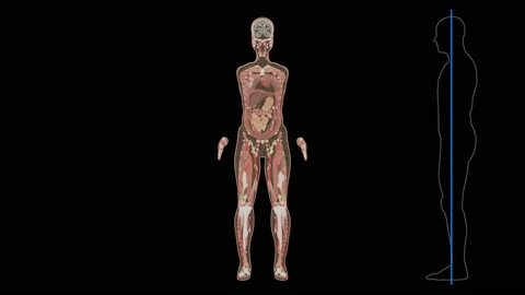 Full body internal organs, magnetic resonance imaging scan, coronal front, 4k Stock Footage 147534519