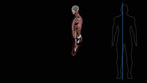 Full body with internal organs MRI, computed tomography, left sagittal plane, 4k Stock Footage 147534504