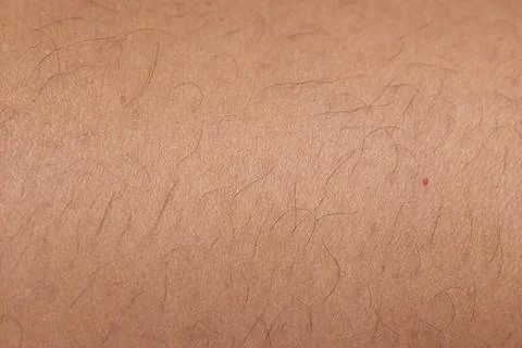 Full frame background human skin texture epithelium cells with hair and mole Stock Photos