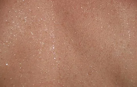 Full frame background of water drops collected on smooth skin Stock Photos