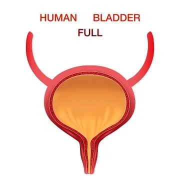 Full Urinary bladder. Human organ anatomy. Editable vector illustration in Stock Illustration