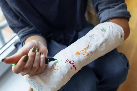 Fun creative fun to draw on plaster cast on broken arm Stock Photos