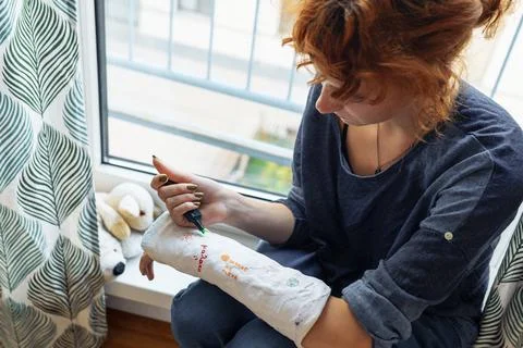 Fun creative fun to draw on plaster cast on broken arm Stock Photos