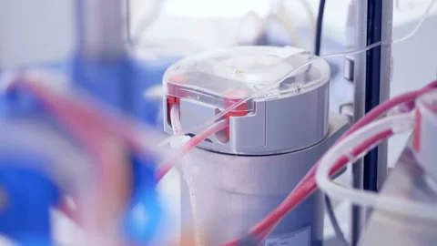 Functioning blood filter of a special medical machine Video stock 87988806