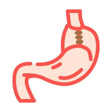 Fundoplication surgery color icon vector illustration 스톡 일러스트