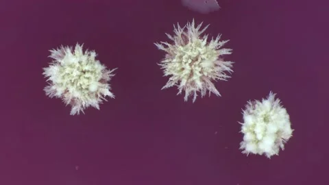 Fungi and bacteria collected from mobile electronic surfaces Stock Footage 233080135