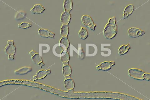 Fungi Coccidioides immitis, saprophytic stage, 3D illustration: Graphic ...