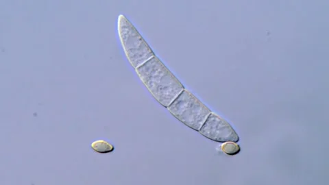 Fungi spore under high resolution microscope, Mold and Fusarium Fungus Video stock 317810080