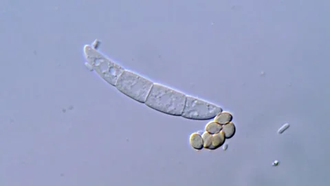 Fungi spore under high resolution microscope, 1000x Vidéo 317812172