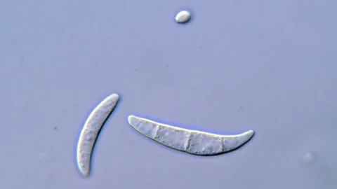 Fungi spores under DIC microscope 動画素材 317810307