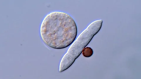 Fungi spores under microscope view, Fusarium and mold 1000x 動画素材 317812578