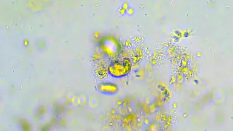 Funny microorganism under microscope. Stock Footage 275169385