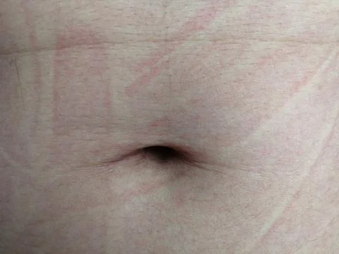 Furrow on abdominal surface Stock Photos