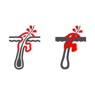 Furuncle line and solid icon, Human diseases concept, pustule sign on white Stock Illustration